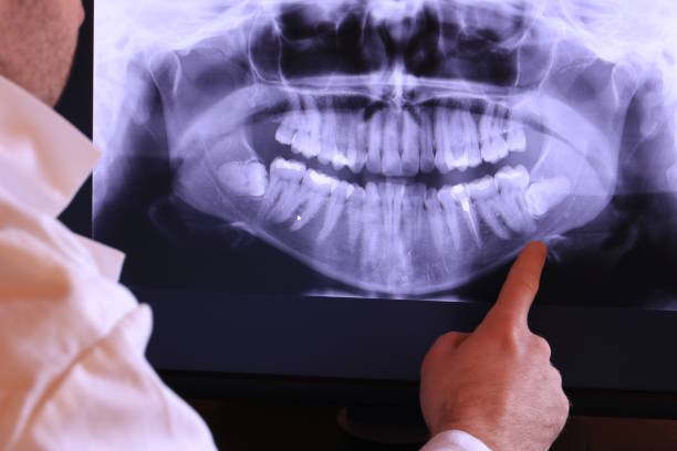 Best 24-Hour Emergency Dentist in Red Bluff, CA