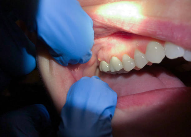 Best Emergency Dental Care for Trauma or Injury in Red Bluff, CA