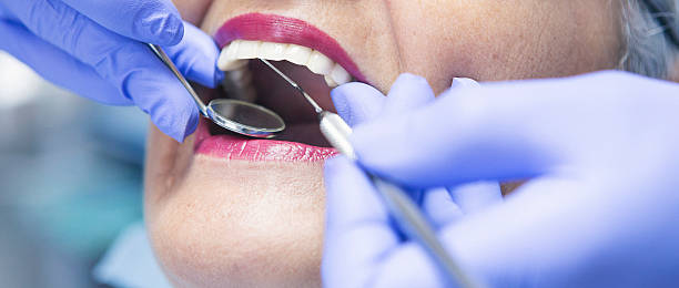 Best Emergency Wisdom Teeth Removal in Red Bluff, CA