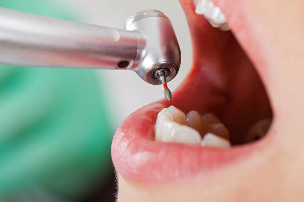 Best Emergency Orthodontic Repairs in Red Bluff, CA
